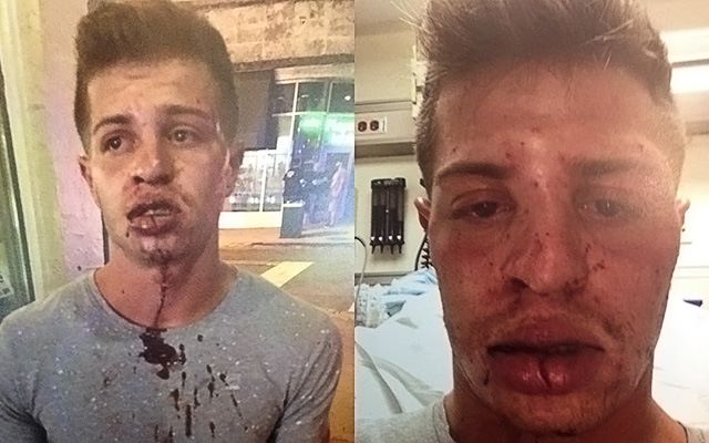 Young man beaten for kissing boyfriend at Burger King.