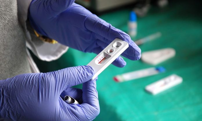 HIV test